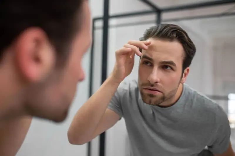 5 Common Mistakes to Avoid When Restoring Your Receding Hairline