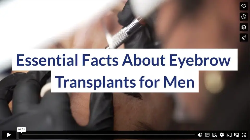 Essential Facts About Eyebrow Transplants for Men