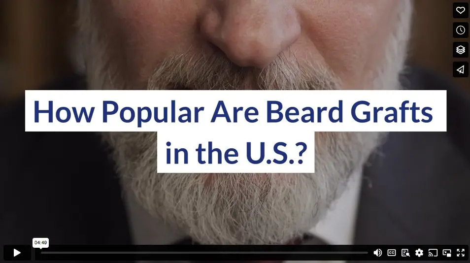 How Popular Are Beard Grafts in the U.S.?