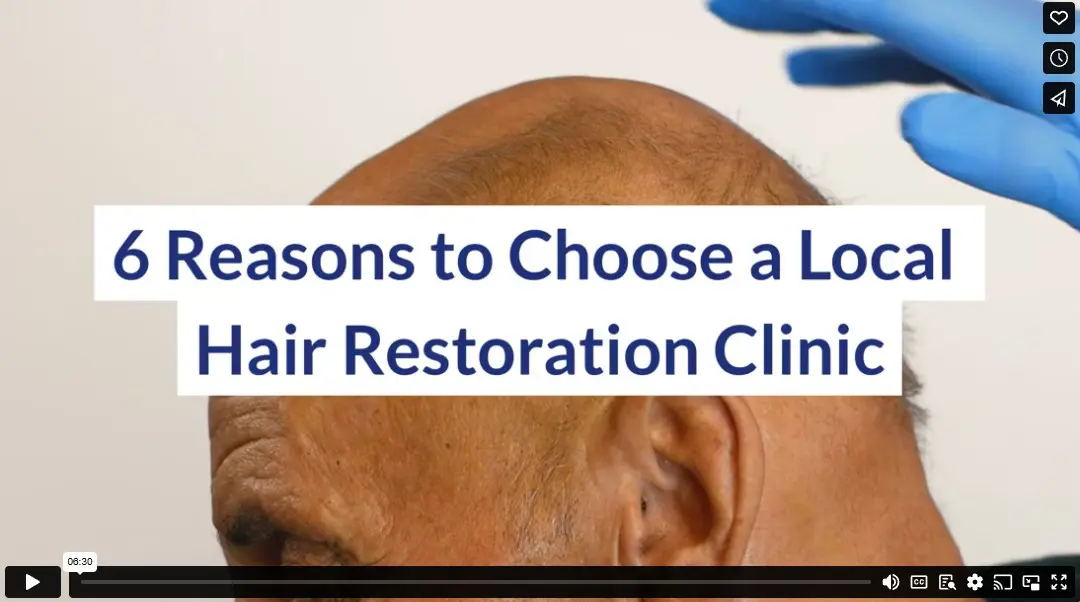6 Reasons to Choose a Local Hair Restoration Clinic