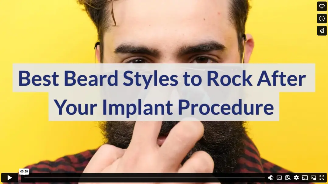 Best Beard Styles to Rock After Your Implant Procedure