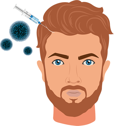 Hair Restoration with Exosomes