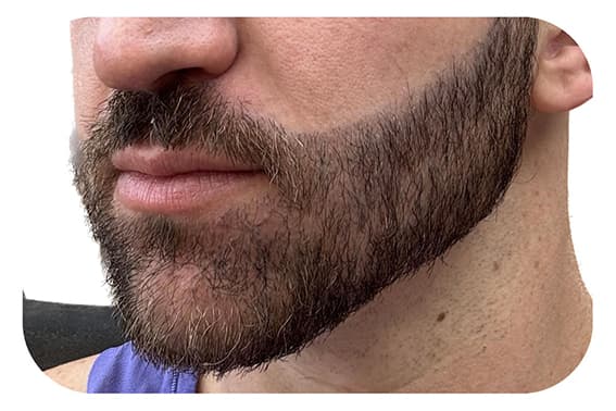 Beard after transformation Beard after transformation