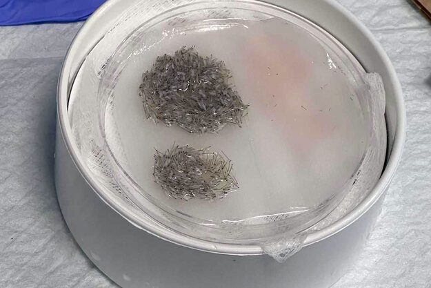 Creating the recipient site