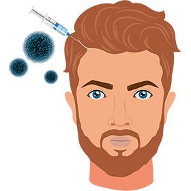 Hair Restoration with Exosomes<br />
