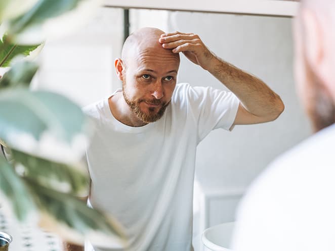 Hair loss men