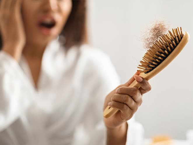 Hair loss women