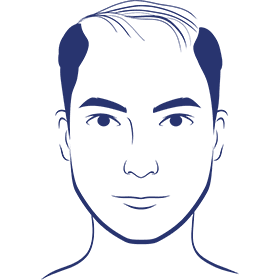 Scalp treatment