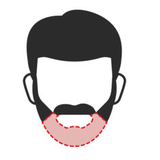 Restoration for Chin