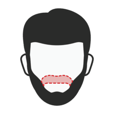 Restoration for Mustache