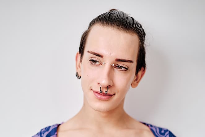 Scalp Restoration for Transgender Women