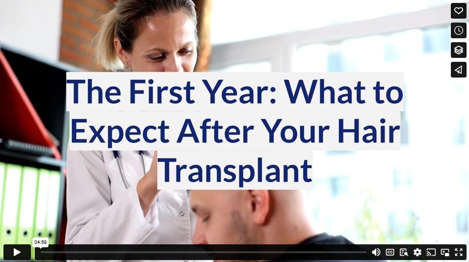 The First Year: What to Expect After Your Hair Transplant