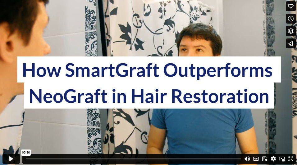 How SmartGraft Outperforms NeoGraft in Hair Restoration
