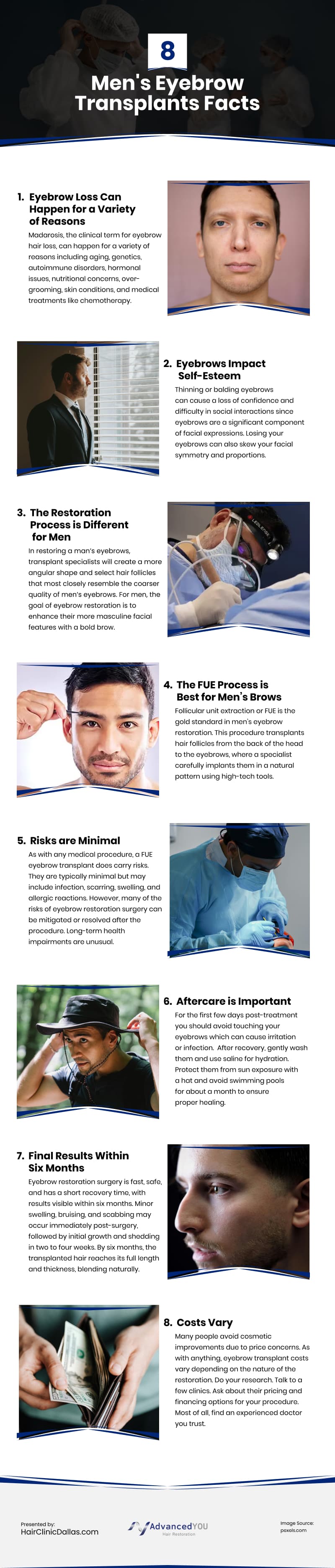 8 Men's Eyebrow Transplants Facts Infographic
