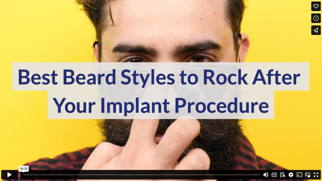 Best Beard Styles to Rock After Your Implant Procedure