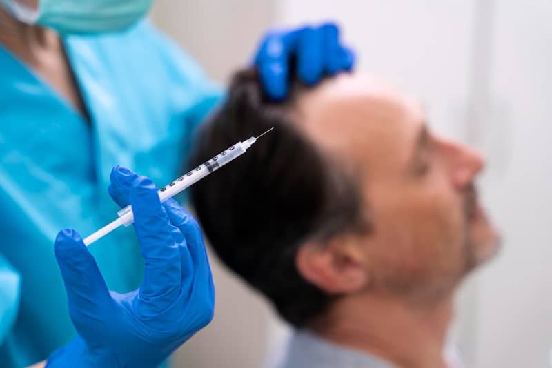 Exosome Hair Restoration Is More Effective Than Topical Chemical Treatments